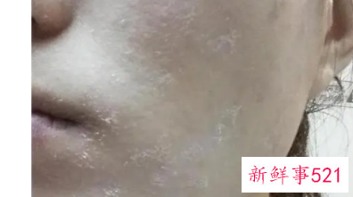 为什么皮肤补水之后变白了