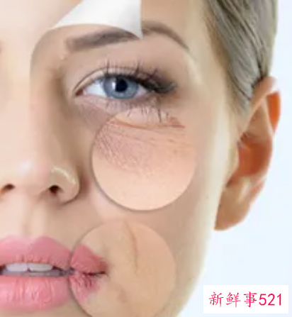 女性全身皮肤粗糙