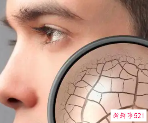 女性全身皮肤粗糙