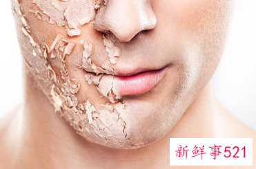 干性皮肤怎样深层补水