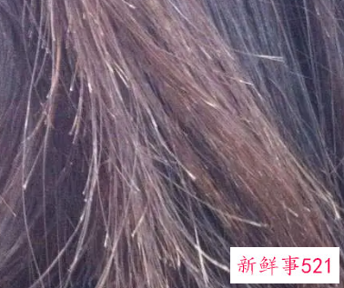 头发分叉严重怎么办