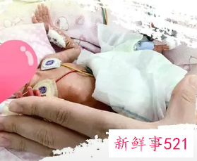 刚出生婴儿的外貌神态描写