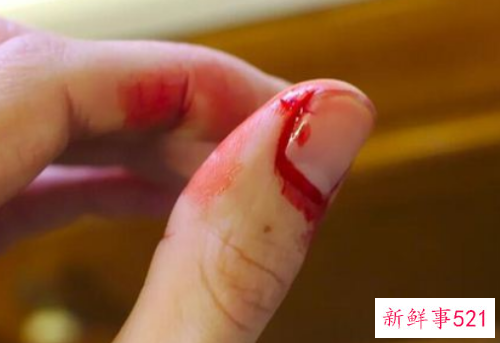 梦见被树枝割伤什么意思