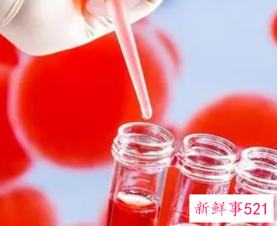 血浆蛋白低有什么症状