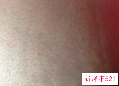 每年冬天乳房瘙痒正常吗