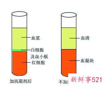 血浆蛋白低有什么症状