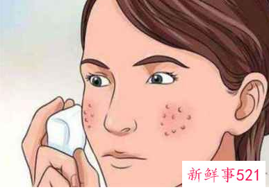 真正能缩小毛孔的方法