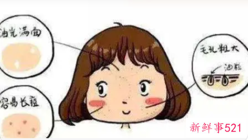 油性皮肤怎么根治痘痘用什么药