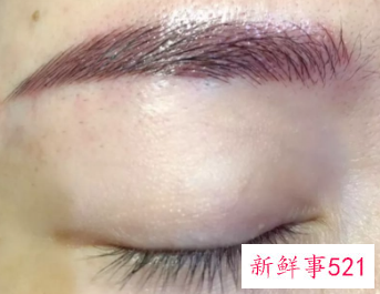 生眉毛最有效的方法用什么药好