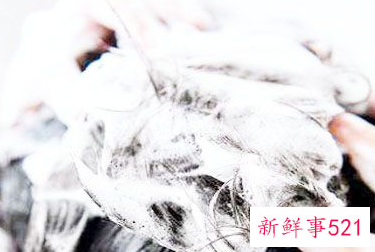 头发爱出油怎么办