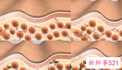 活性细胞去皱效果怎么样