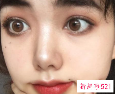 什么痣比较好看