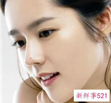 什么痣比较好看