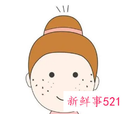 祛斑后要注意些什么