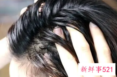 怎么根治油性头发