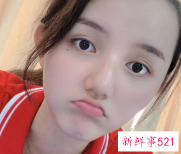 什么痣比较好看