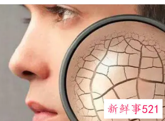 过敏后脸干燥紧绷脱皮
