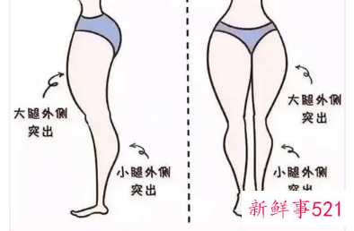 如何判断是不是小腿外翻