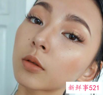 什么痣比较好看