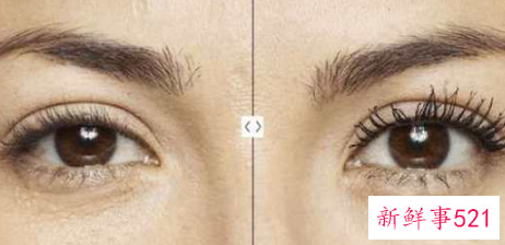 天生小眼睛怎么变大