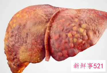 肝不好的人的症状