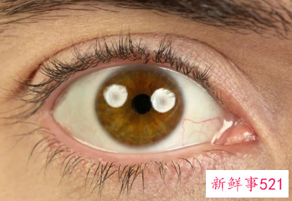 经常用眼贴危害