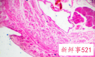 念珠菌感染是霉菌性感染吗
