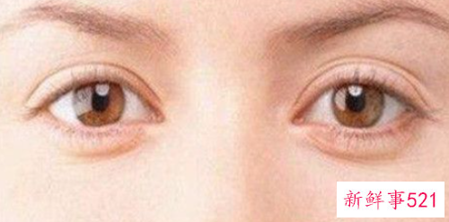 眼袋和卧蚕的区别有哪些