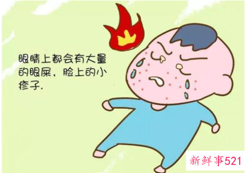 五岁宝宝上火怎么处理