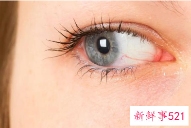 经常用眼贴危害