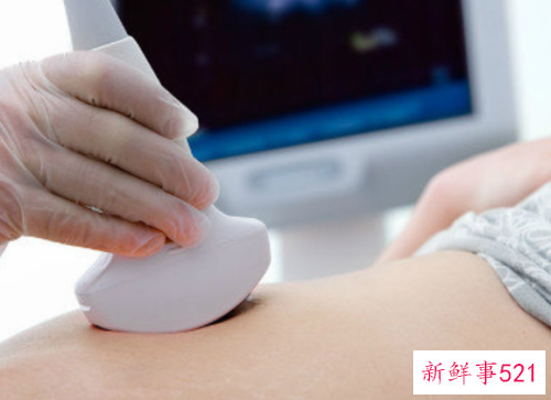 分娩阵痛仪器的原理