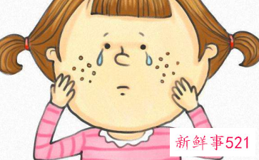 如何改善毛孔问题