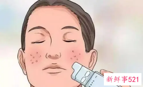 男人皮肤爱出油是什么原因