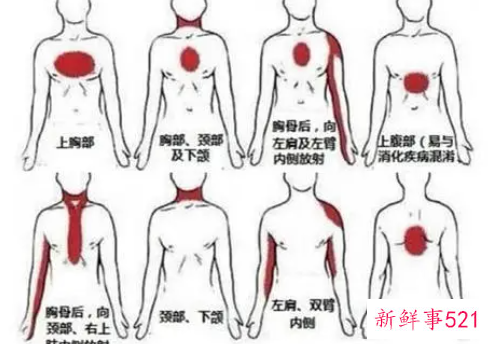 人体背部疼痛对应器官