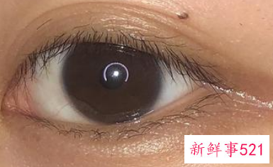 眼角是红色的怎么回事