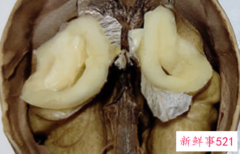 鲜核桃和干核桃的区别