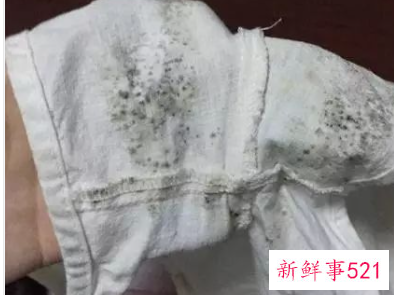 纯棉布发霉了怎么办洗掉