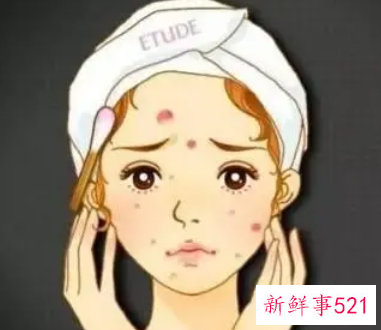 如何淡化痘痘留下的黑印