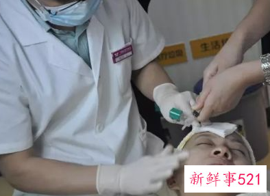 如何淡化痘痘留下的黑印