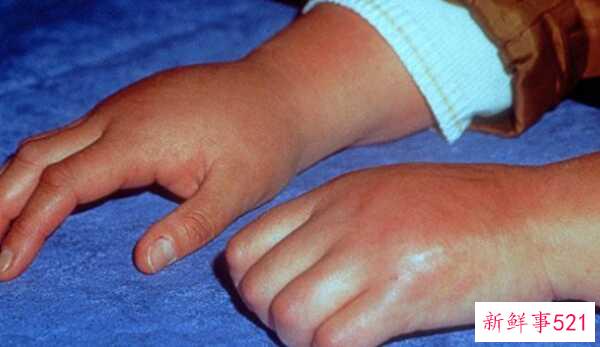 人最痛苦的是什么？揭秘人世间最痛苦的10件事