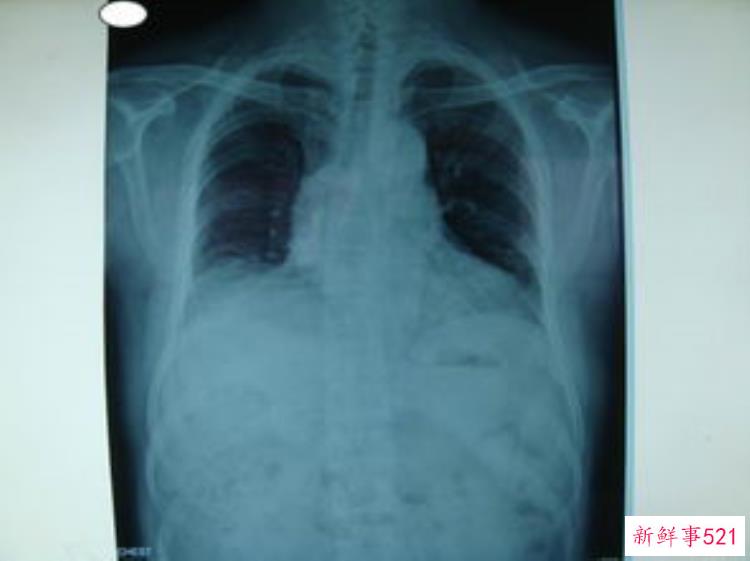 血管外科的起点，血管外科的常见病