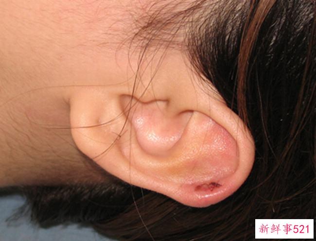 一夜不戴耳环会死吗？打耳洞后需要注意什么？