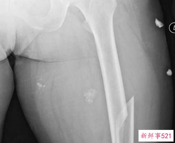 人最痛苦的是什么？揭秘人世间最痛苦的10件事