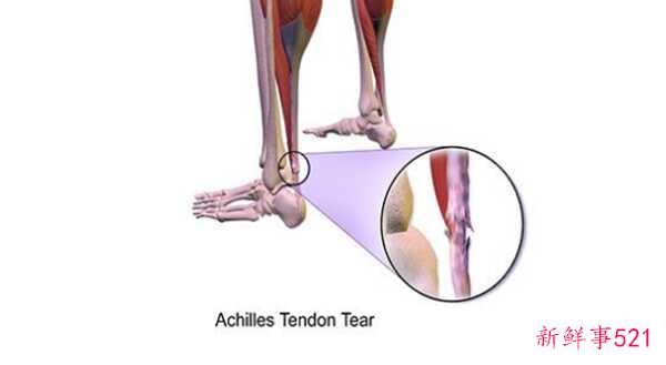 人最痛苦的是什么？揭秘人世间最痛苦的10件事