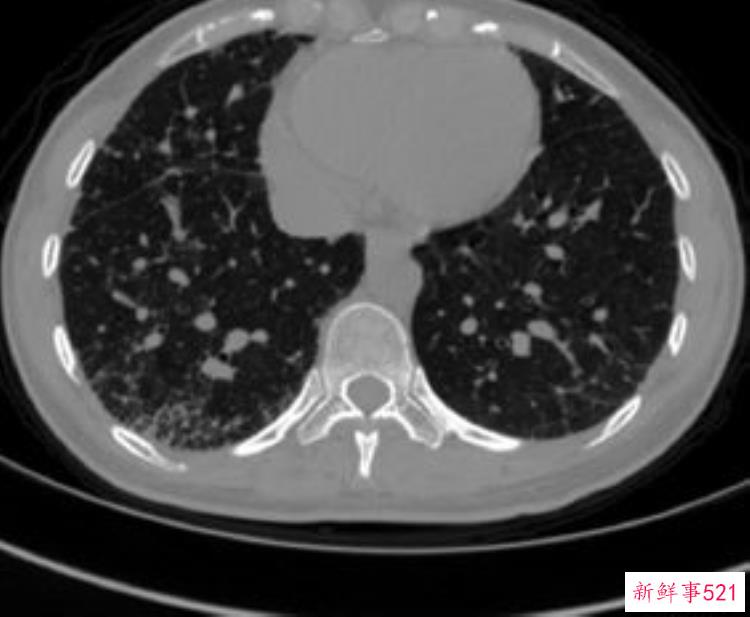 bbc轰动全球的恐怖直播，恐怖诡异小短片