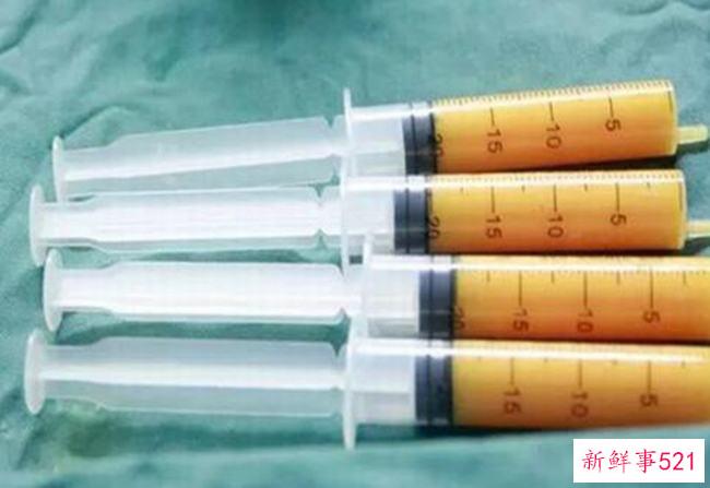 吃多了肌肉或脂肪 哪种物质可以减脂(肌肉重量)？