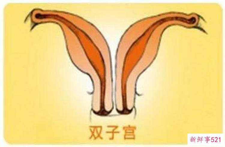 子宫畸形，子宫畸形对生育的影响