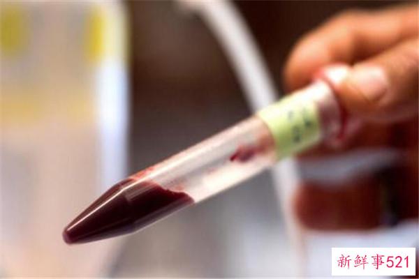 400毫升血多少钱？实际上它的重量是0.84公斤(密度比水高)