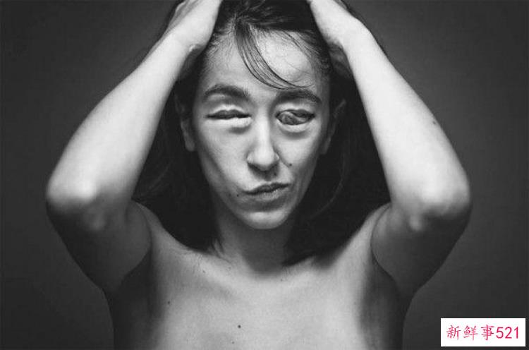 超重口味摄影集肢体重组宛如寄生兽