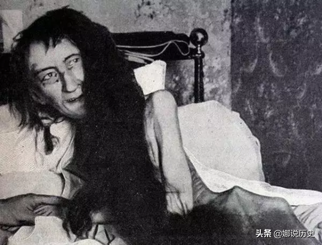 她是一国贵族夫人，却软禁女儿25年，被救出后衣着破烂不会说话